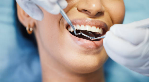Best Dentist for Tooth Abscess  in Estancia, NM