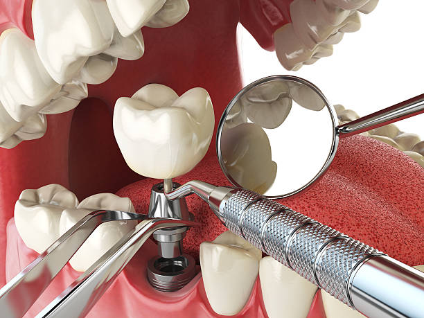 Best Knocked-Out Tooth Emergency  in Estancia, NM